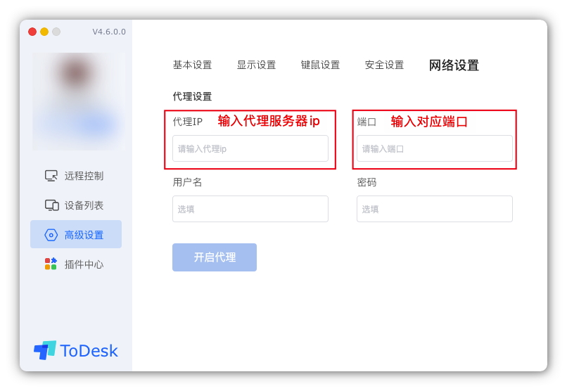 设置网络代理